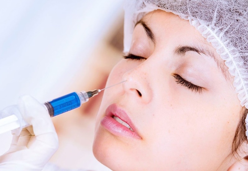 Tiêm Filler nâng mũi có hiệu quả nhanh