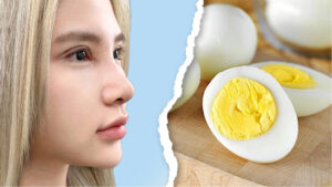 Sửa mũi có ăn trứng được không? Chuyên gia giải đáp & lưu ý dinh dưỡng