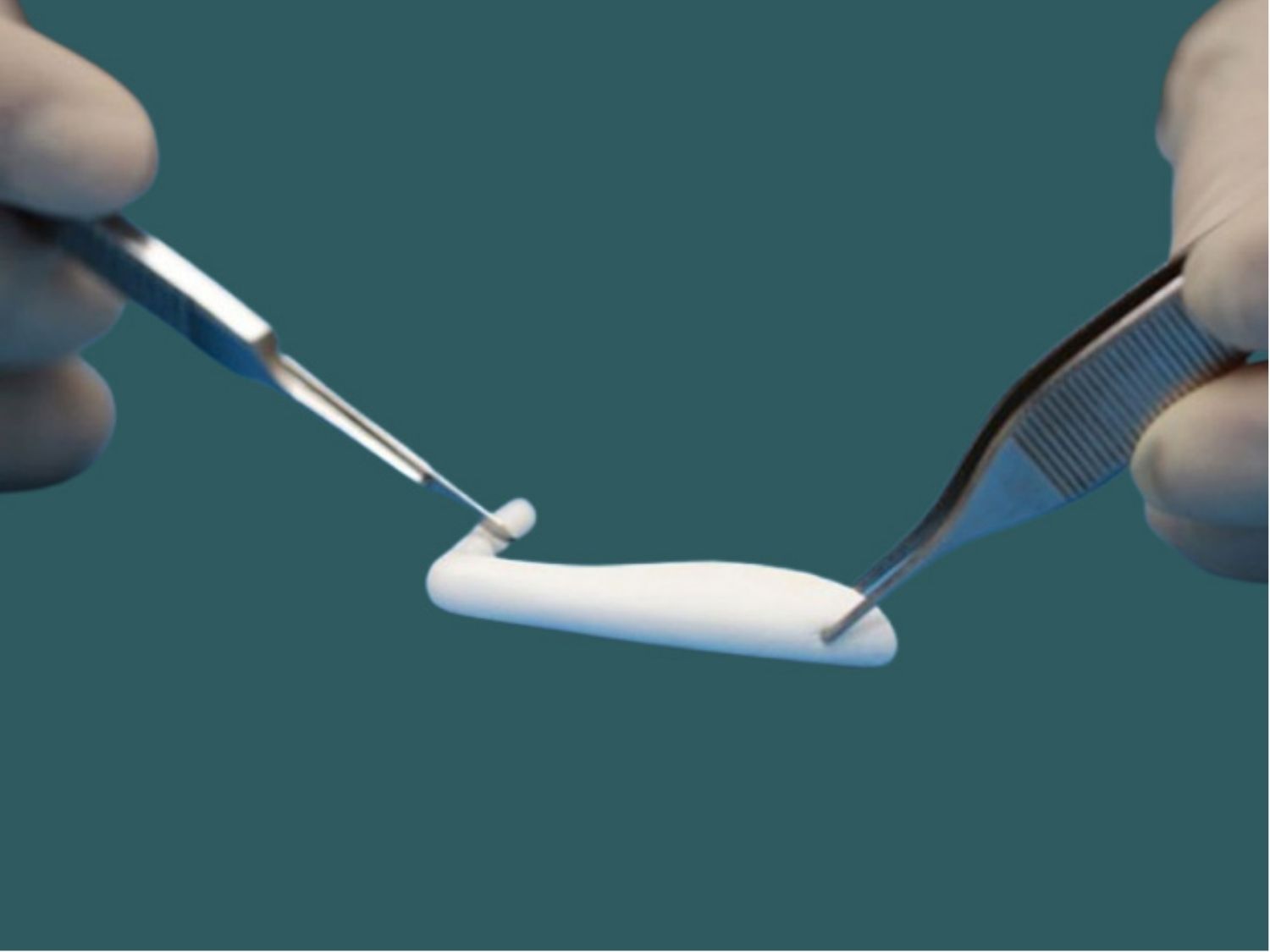 Sụn nhân tạo nâng mũi có nhiều loại khác nhau, phù hợp với các tình trạng mũi khác nhau