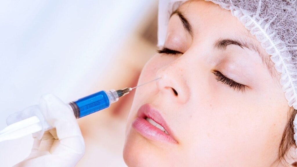 Tiêm filler duy trì được bao lâu? Khi nào cần dặm lại filler