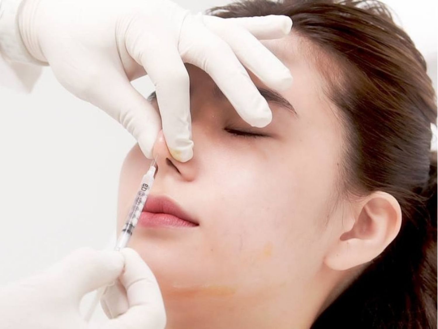 Bác sĩ có chuyên môn trực tiếp thực hiện