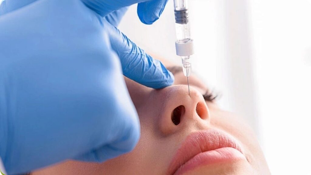 Tiêm filler mũi sau nâng có an toàn không? Những điều bắt buộc phải biết