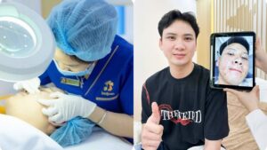 Trị mụn tại Kangnam TP.HCM – Giải pháp điều trị mụn an toàn, chuẩn da liễu