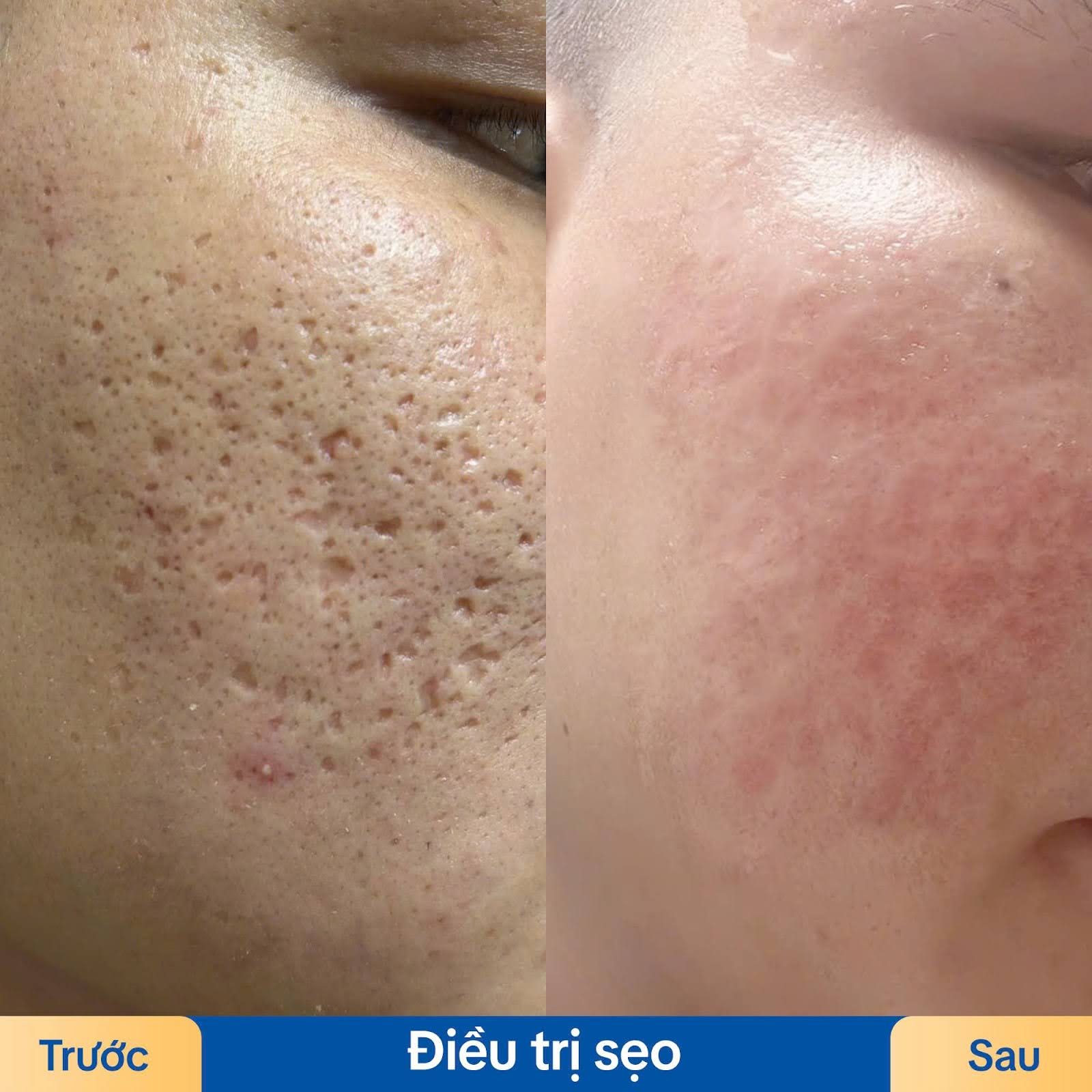 Da của khách hàng mịn màng, tươi sáng hơn