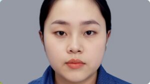 Trường hợp nào nên cắt mí? Cách xác định bạn có thực sự cần cắt mí hay không