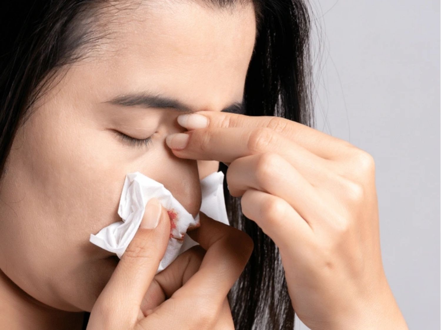 Chảy máu cam tái diễn