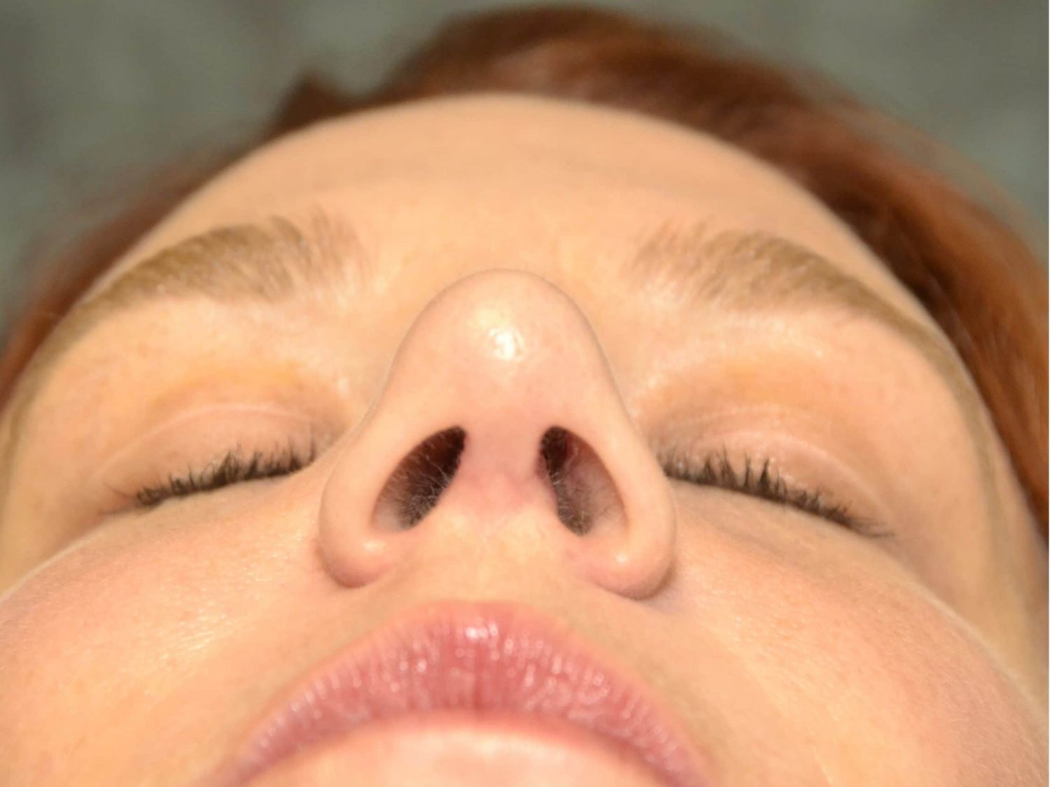 Vách ngăn mũi là bộ phận nằm giữa hốc mũi