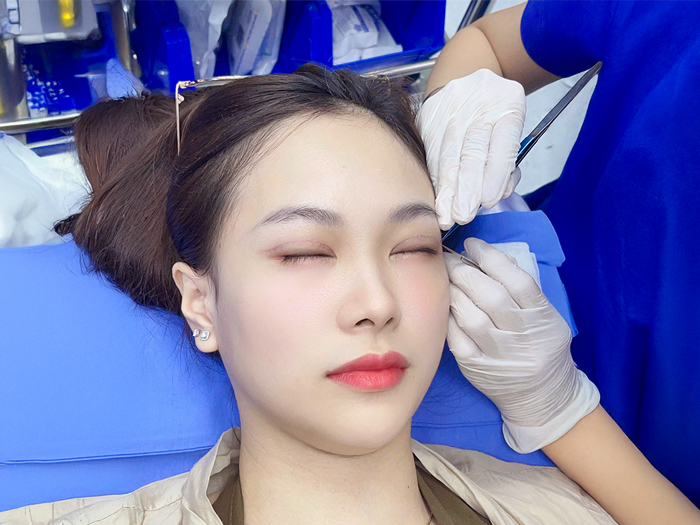 khách hàng đang cắt chỉ mí bởi y tá, cắt chỉ hoàn toàn nhẹ nhàng và không đau