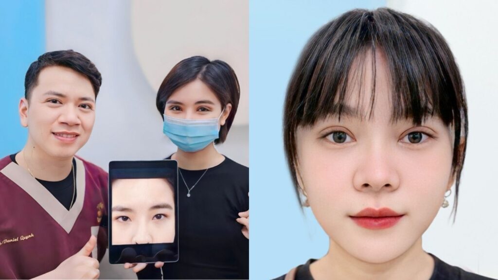 TOP Bác sĩ cắt mí giỏi Bắc – Trung – Nam: Danh sách chuyên gia uy tín và Tiêu chuẩn chọn lựa 2026