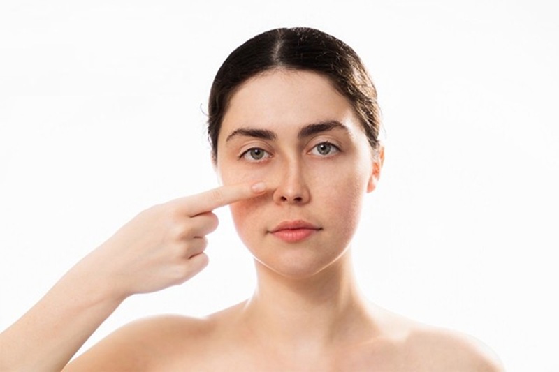 Không bảo hành nâng mũi với trường hợp do va chạm, tai nạn khiến mũi bị lệch, vẹo