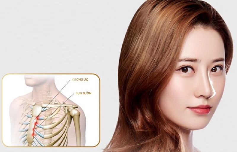 Có bảo hành cho nâng mũi sụn sườn ở cơ sở thẩm mỹ uy tín