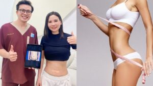 Bao nhiêu tuổi được hút mỡ? Độ tuổi an toàn theo khuyến cáo