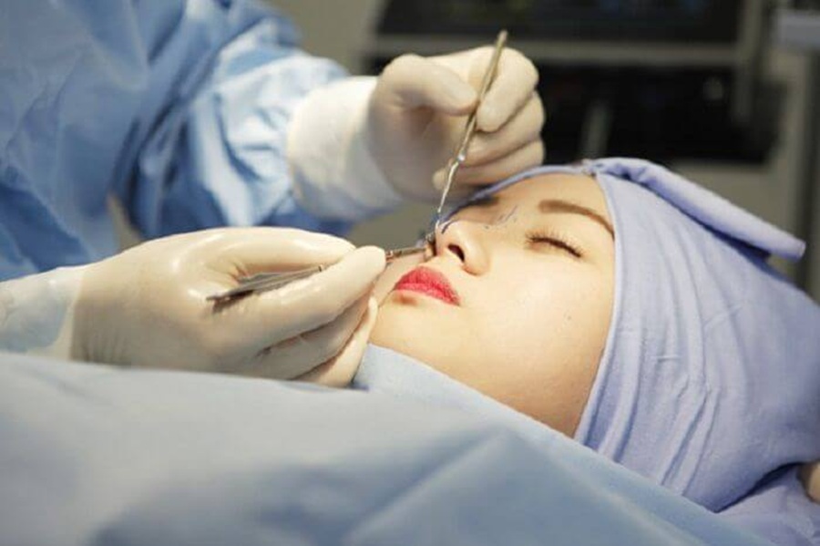 Tay nghề bác sĩ ảnh hưởng tới thời gian cắt chỉ sau nâng mũi ở mỗi người khác nhau