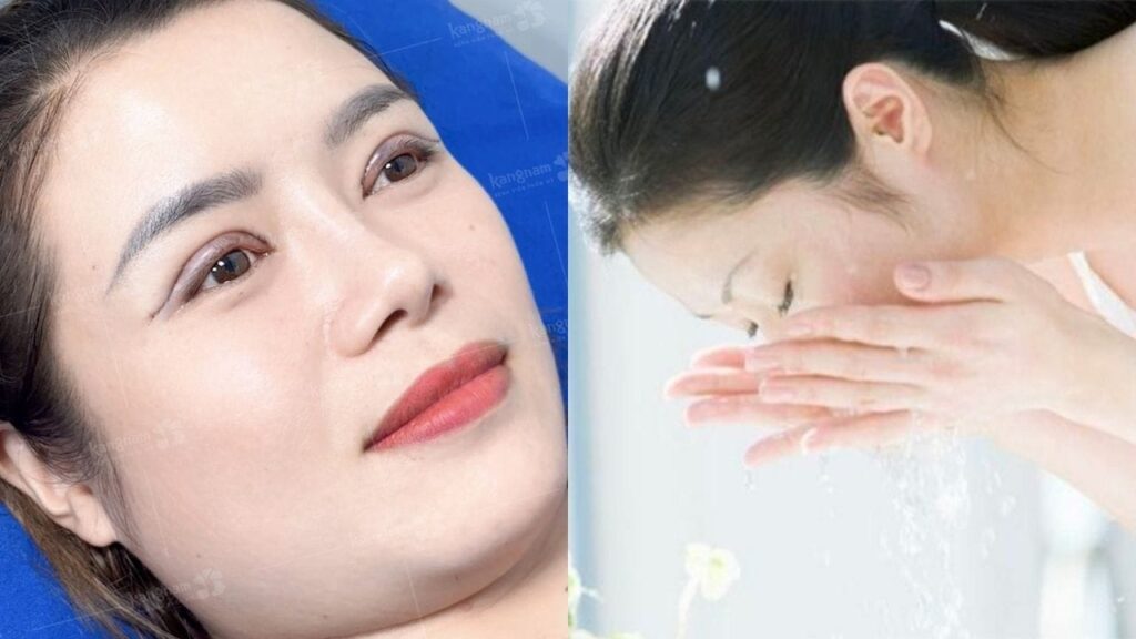 Hướng dẫn rửa mặt sau cắt mí chuẩn Y khoa: Cách kiêng nước an toàn, tránh nhiễm trùng