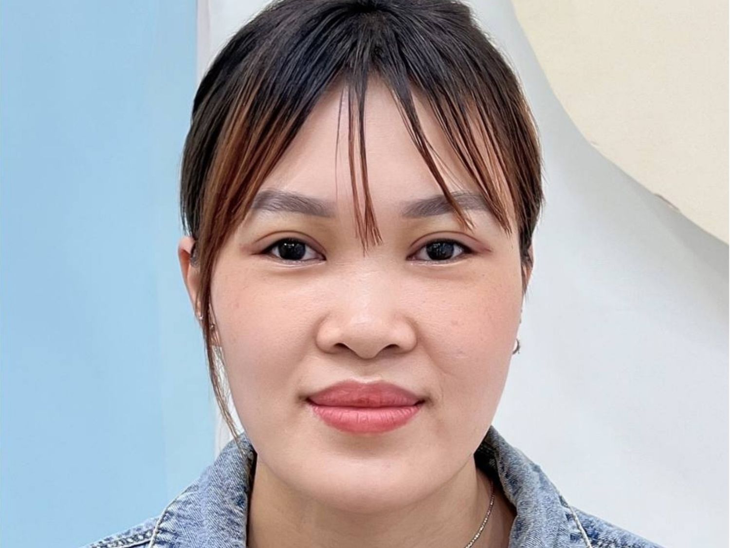 đường mí khô, ổn định và phục hồi tốt của khách hàng chỉ sau 7 ngày