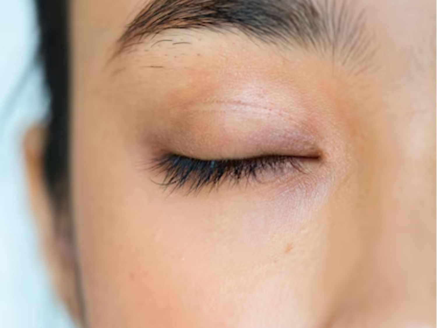 cắt mí không bị lộ khi nhắm mắt, do bác sĩ thực hiện đúng kỹ thuật, thiết kế nếp mí phù hợp với cơ địa da vùng mắt