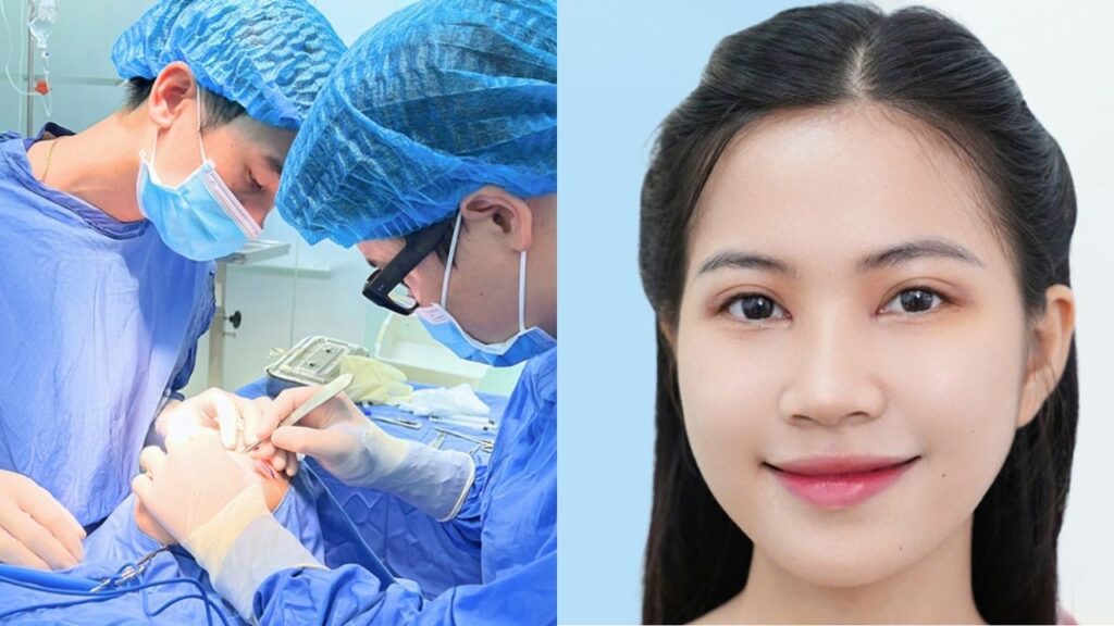 Cắt mí có cần gây mê? Sự thật về gây tê tại chỗ và quy trình an toàn Y khoa