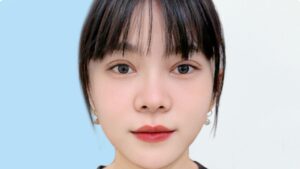 Cắt mí có đều không? Phân tích 5 nguyên nhân gây lệch mí và cách khắc phục từ bác sĩ