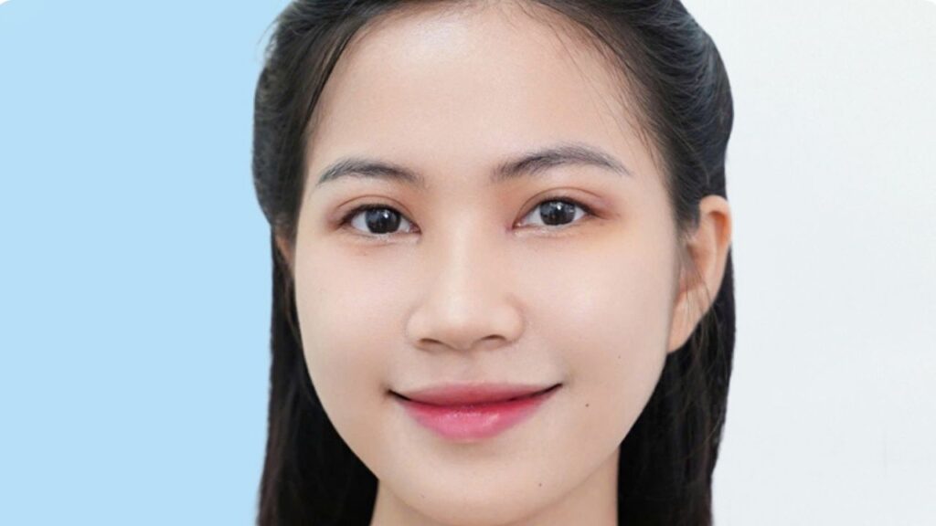 Cắt mí có tác dụng gì? 5 lợi ích kép về thẩm mỹ và thị lực bạn cần biết