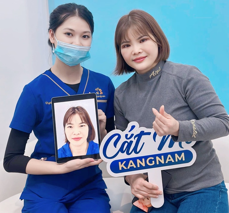 Khách hàng hài lòng và tin tưởng khi cắt mí tại Kangnam Hà Nội với nếp mí to tròn, rõ và cân đối với khuôn mặt
