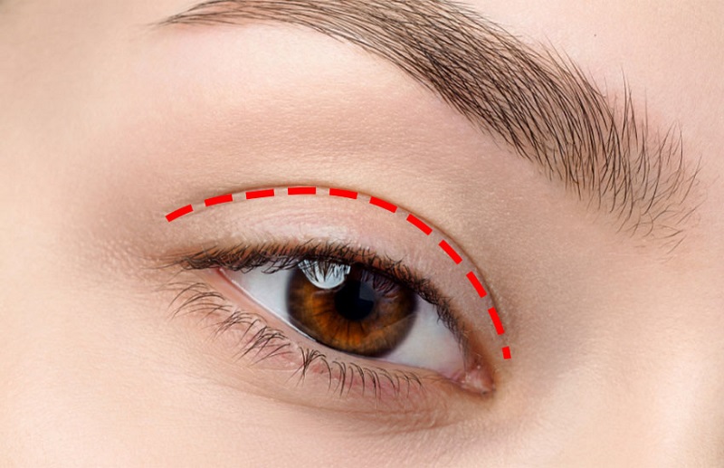 Nhấn mí chỉ tác động vào vùng da và cơ nâng mi, không can thiệp cấu trúc mắt