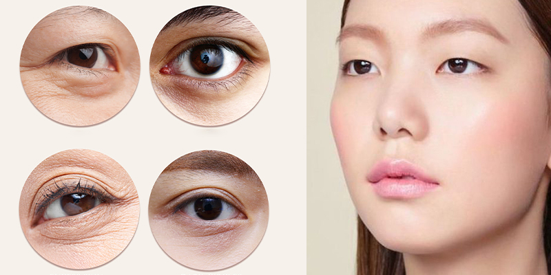 Mini Deep là sự kết hợp giữa nhấn và cắt (vừa tự nhiên vừa bền) giúp mắt rõ nếp mí có độ bền lâu dài và mang lại hiệu quả thẩm mỹ cao