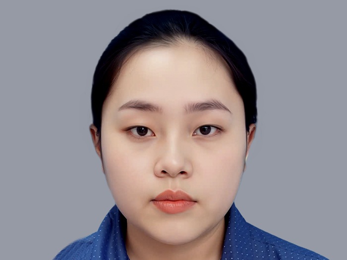 Nên cắt mí khi mí không rõ nếp, nhìn sụp mí khiến vùng da mắt bị chùng xuống trông kém sức sống