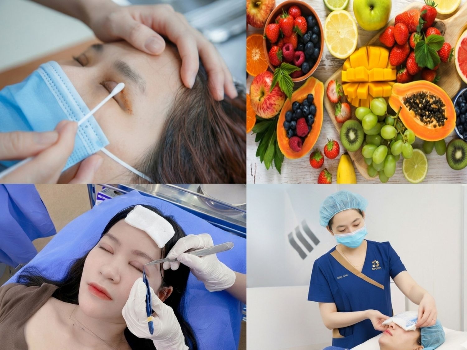 Khách hàng cần chườm lạnh sau cắt mí, vệ sinh nếp mí sạch sẽ, ăn uống đầy đủ dưỡng chất và tái khám theo lịch hẹn để cắt chỉ