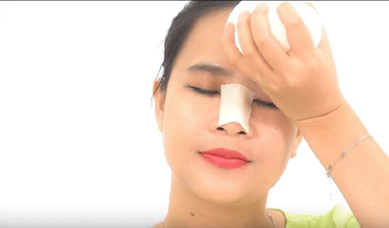 Chườm lạnh sau 24h nâng mũi để giảm đau, giảm sưng