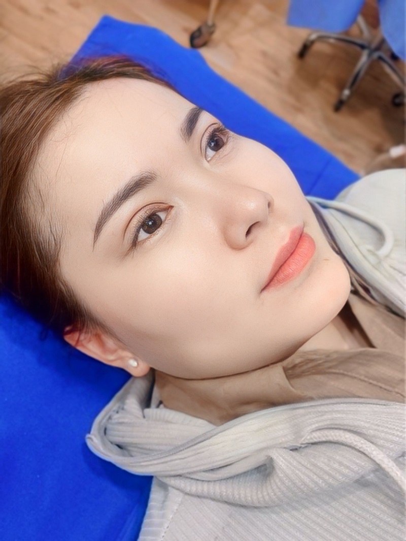 Tỉ lệ vàng trong phẫu thuật cắt mí dựa trên khoảng cách giữa nếp mí, cung mày và trục đuôi mắt.