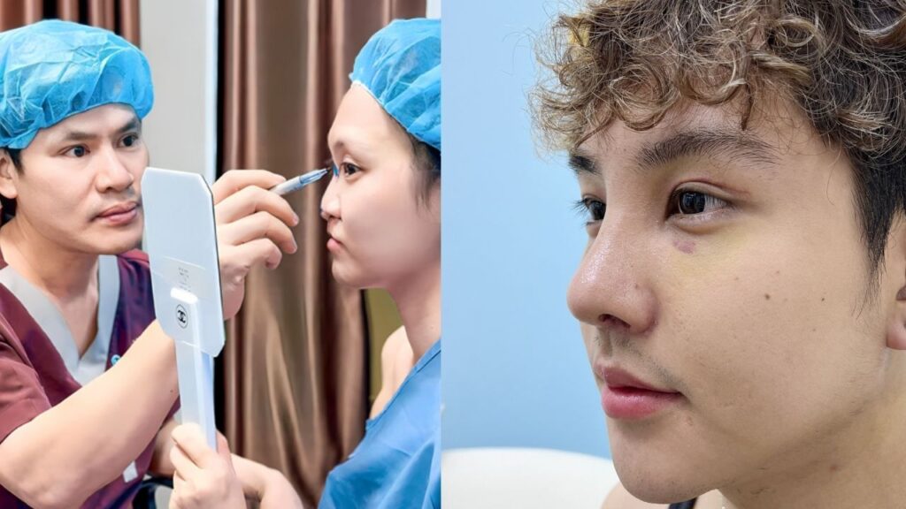 Dáng mũi phù hợp khuôn mặt: Chọn đúng dáng mũi hài hòa, tự nhiên