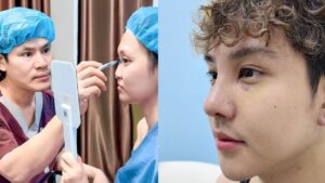 Dáng mũi phù hợp khuôn mặt: Chọn đúng dáng mũi hài hòa, tự nhiên