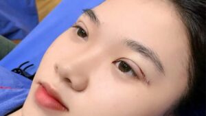 Địa chỉ cắt mí uy tín tại Hà Nội: Cách chọn nơi làm an toàn và phù hợp