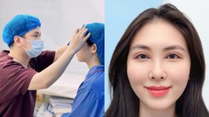 Địa điểm cắt mí uy tín Bắc, Trung, Nam – Cập nhật mới nhất năm 2026