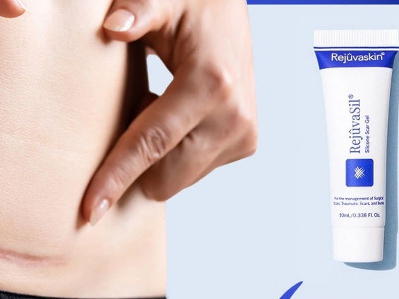 Dùng gel trị sẹo theo hướng dẫn của bác sĩ sẽ giúp vết sẹo nhanh mờ