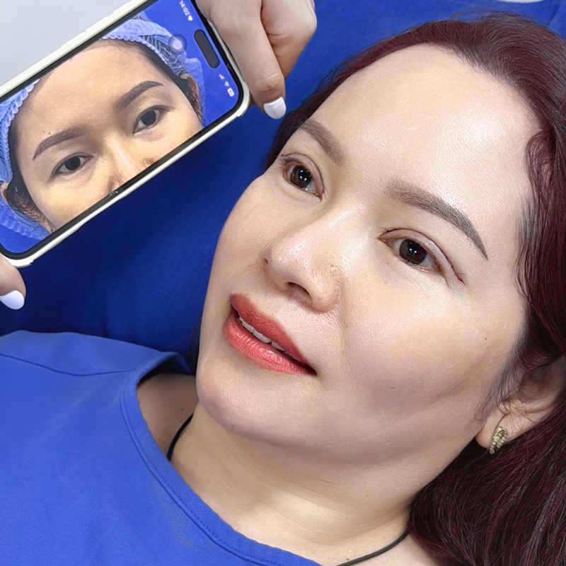 Giá cắt mí Hàn Quốc trên thị trường khá cao dao động lên tới hàng chục triệu đồng