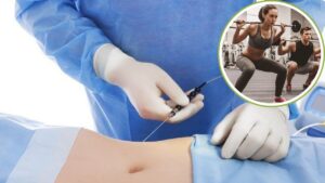 Hút mỡ bao lâu tập Gym được? Lộ trình vận động 4 giai đoạn từ Bác sĩ Kangnam