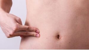 Tại sao bụng bị cứng sau hút mỡ? Bí quyết massage và đeo gen để bụng nhanh mềm 2026