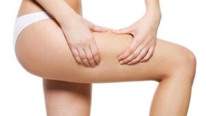 Hút mỡ bị sưng một bên: 5 nguyên nhân chủ yếu và cách xử lý nhanh nhất