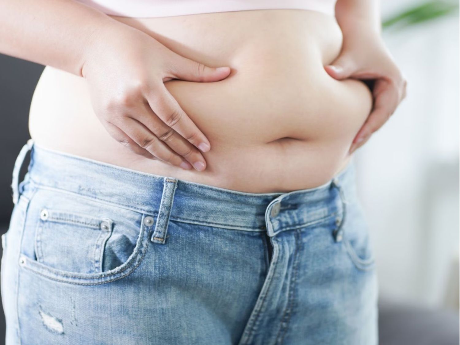 tình trạng mỡ bụng trên khiến nhiều người tự ti