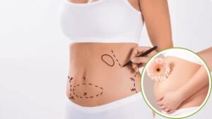 Hút mỡ có ảnh hưởng đến khả năng sinh sản không? Giải đáp từ Bác sĩ Thẩm mỹ