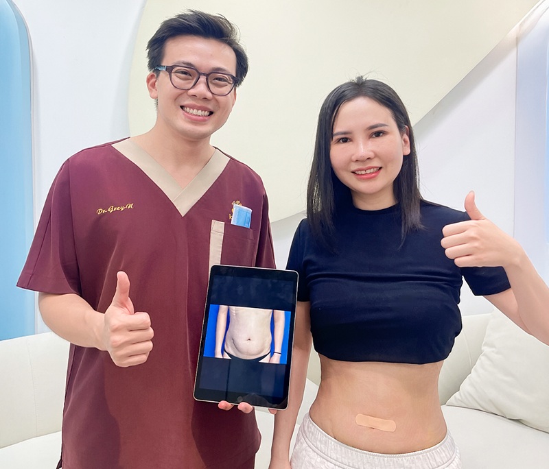 Khách hàng có thể về ngay trong ngày khi hút mỡ diện tích nhỏ sau khi được bác sĩ thăm khám chỉ định