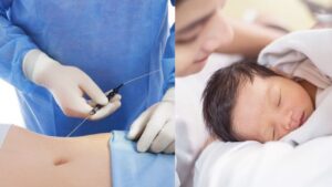 Hút mỡ có đau như sinh con không? Review cảm giác thực tế so với sinh thường và sinh mổ