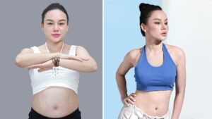 Hút mỡ có giảm cân không? Sự thật về số đo vòng bụng và cân nặng