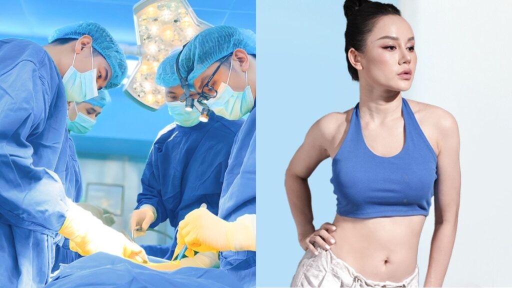 Hút mỡ có vĩnh viễn không? Sự thật về cơ chế tái béo và cách giữ dáng trọn đời