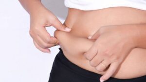 Hút mỡ lần 2 có nguy hiểm không? Tại sao 6-12 tháng mới là thời điểm vàng để tái can thiệp