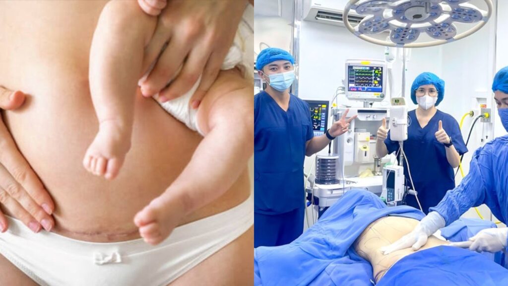 Review hút mỡ sau sinh 2026: Điều kiện thực hiện, mức độ ảnh hưởng tử cung và lộ trình hồi phục