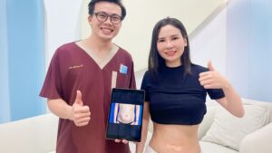 Hút mỡ bao lâu thì hết phù nề? Bí quyết rút ngắn thời gian sưng bầm sau 7 ngày