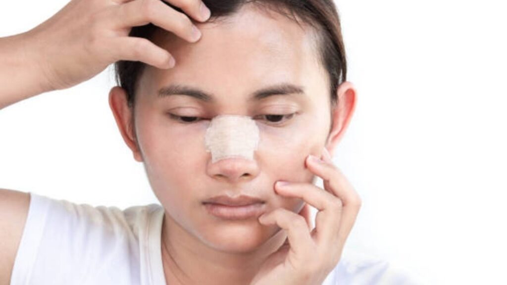 Khi nào cần sửa mũi? Dấu hiệu bắt buộc chỉnh sửa và thời điểm sửa mũi an toàn nhất