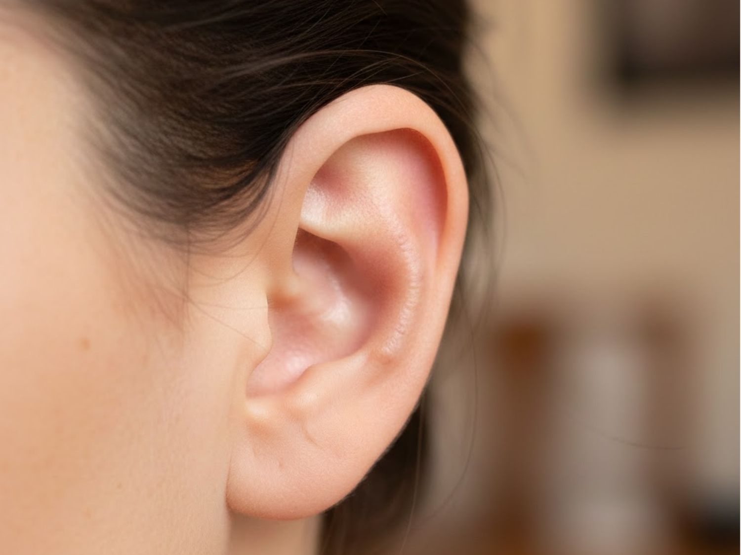 Vết sẹo sau 6 tháng đã mờ gần như hoàn toàn, nhìn qua không hề biết đã lấy sụn ở vành tai